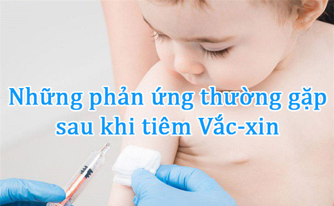 Những phản ứng thường gặp sau khi tiêm Vắc-xin
